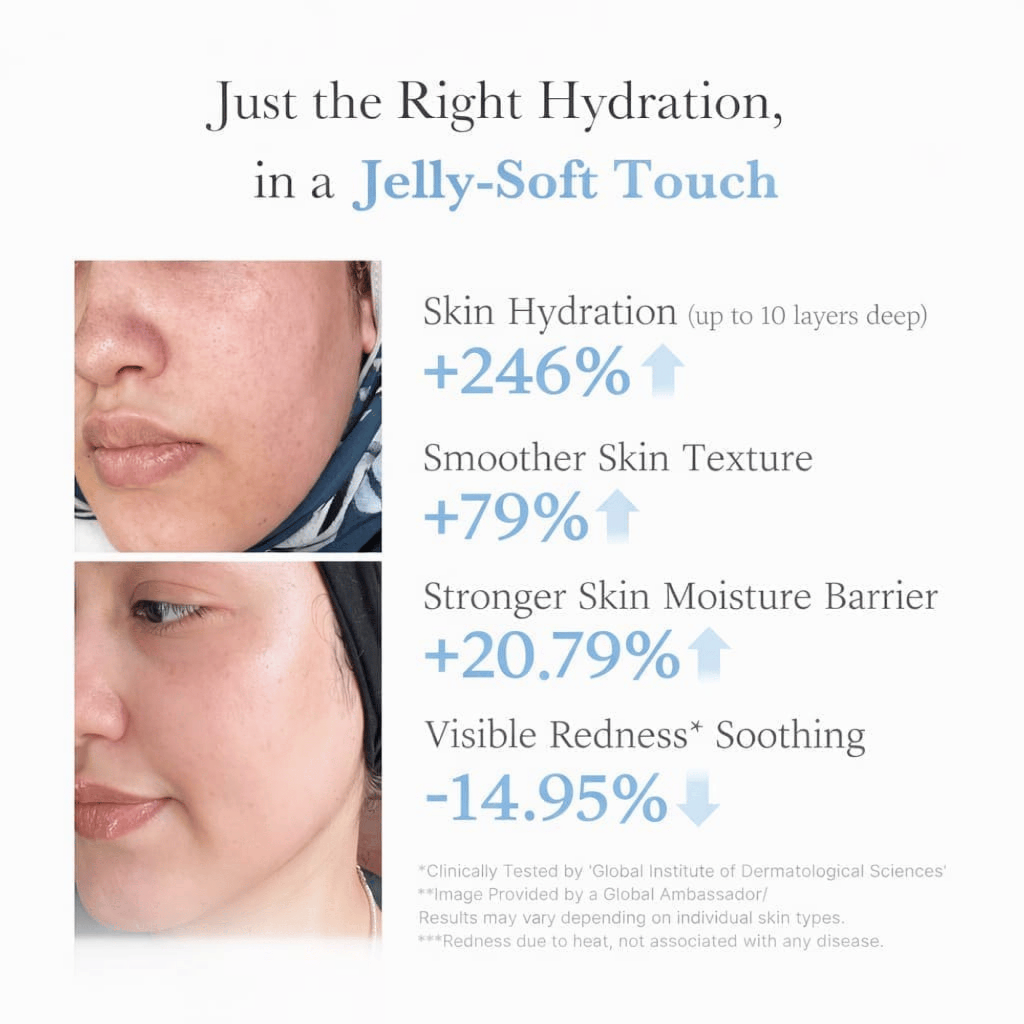 Advertisement for skin hydration product showing before and after effects on skin texture and redness.