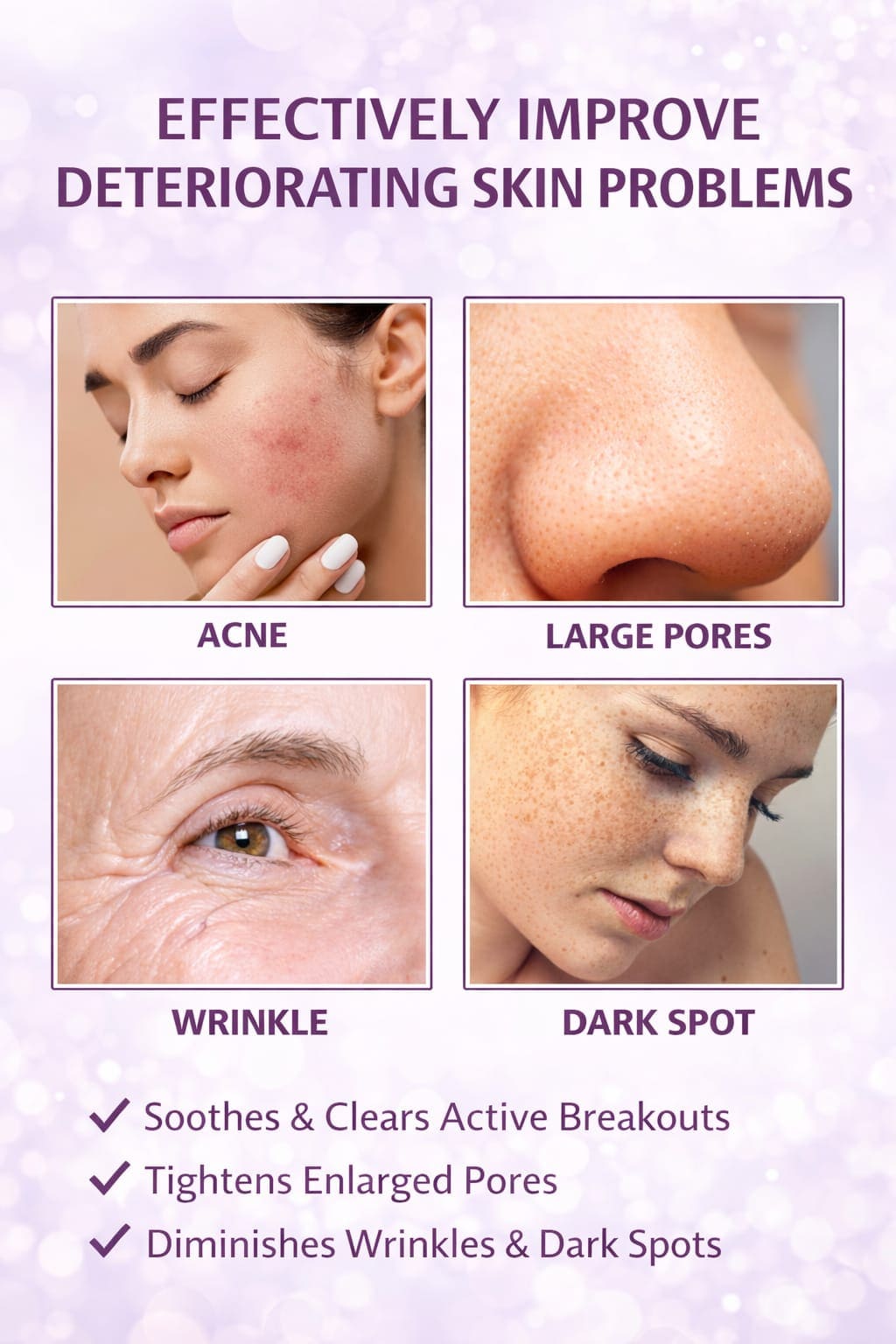 Niacinamide Serum – Lifting, Anti-Wrinkle & Dark Spot Care